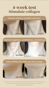 LED Neck Light Therapy Mask – Flexible Skincare Device for Neck & Décolleté Care