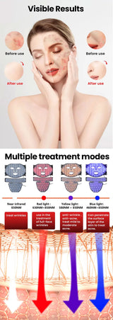 Wireless LED Face & Neck Light Therapy Mask for Skin Rejuvenation & Anti-Aging