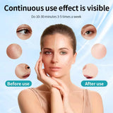 Wireless LED Face & Neck Light Therapy Mask for Skin Rejuvenation & Anti-Aging