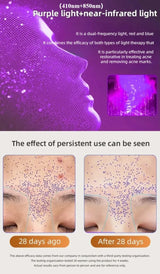 Advanced Wireless LED Face Mask – 7-Color Silicone Light Therapy System