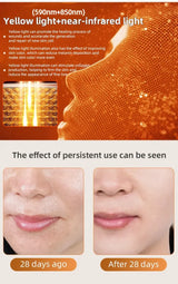 Advanced Wireless LED Face Mask – 7-Color Silicone Light Therapy System